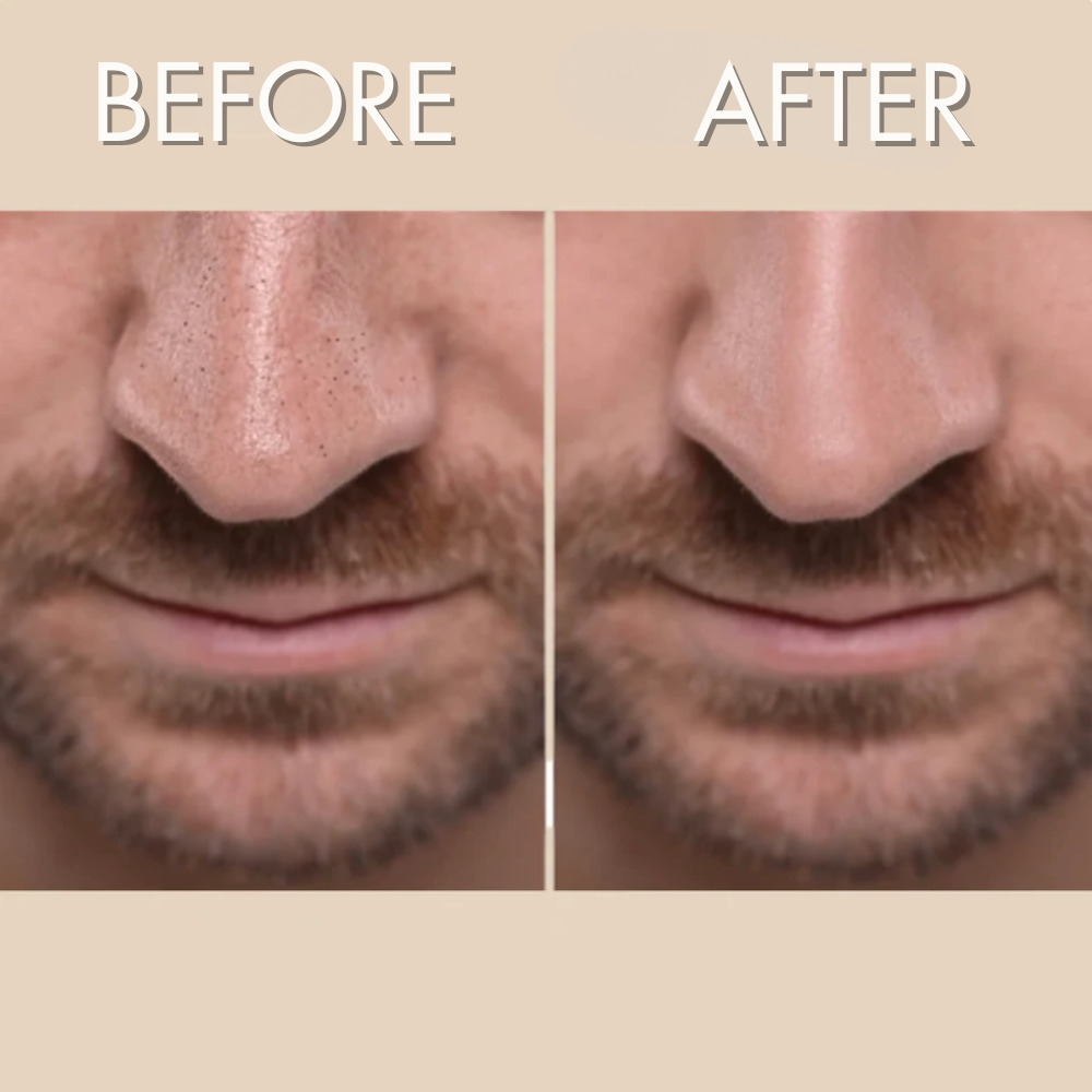 Dr. Melaxin Peel Shot™ Exfoliator