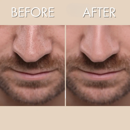 Dr. Melaxin Peel Shot™ Exfoliator